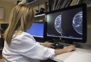 Una médico revisa una mamografía .EFE/ Miguel Angel Polo/Archivo